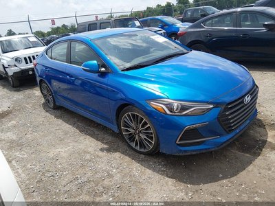 KMHD04LB9HU****** 2017 Hyundai Elantra
