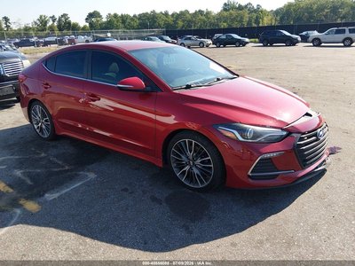 KMHD04LB2HU****** 2017 Hyundai Elantra