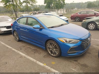 KMHD04LB6HU****** 2017 Hyundai Elantra