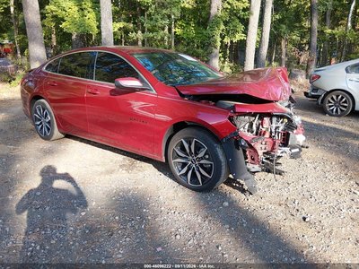 1G1ZG5ST4SF****** 2025 Chevrolet Malibu